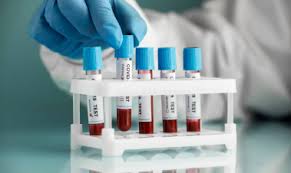 Blood Test Services