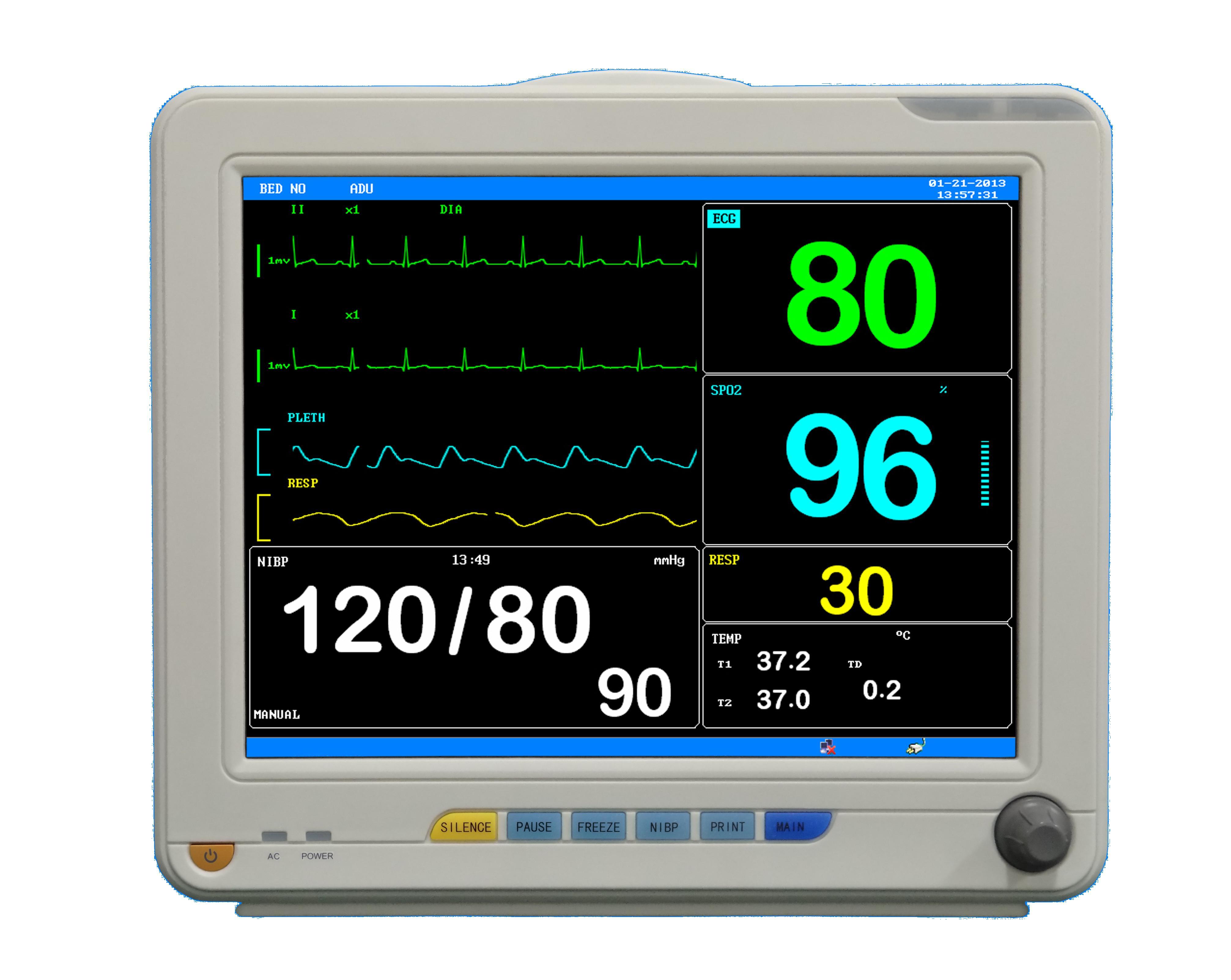 ECG Monitor